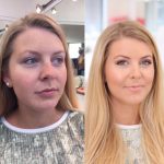 before-and-after